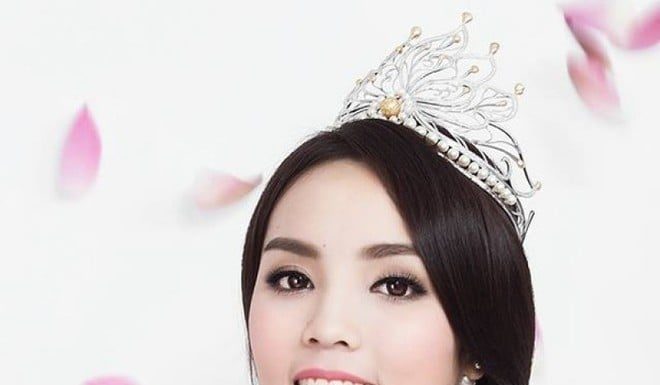 The Once-Criticized Beauty Queens: A Blooming Journey to Stunning Transformations