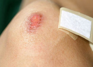 The Hidden Dangers of Wet Wipes: Unveiling the Unknown Threats!