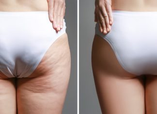 “The Ultimate Guide to Choosing Butt-Lift Jeans for Your Body Type”