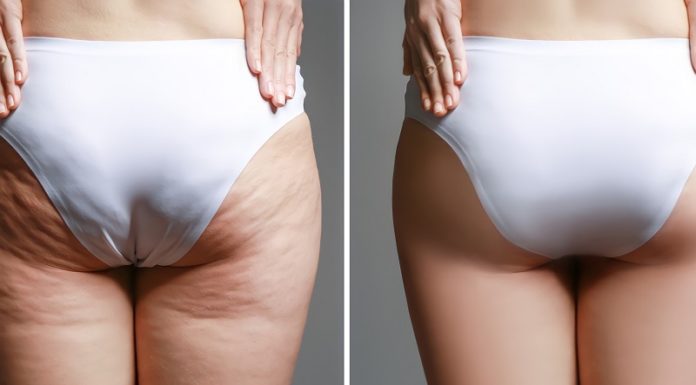 “The Ultimate Guide to Choosing Butt-Lift Jeans for Your Body Type”