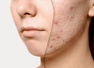 7 Miracle Ingredients to Transform Your Skin and Minimize Pores