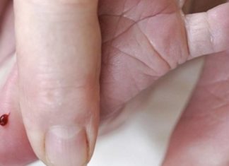 What is a Heel Stick Blood Test? Why is Blood Drawn from a Baby’s Heel?