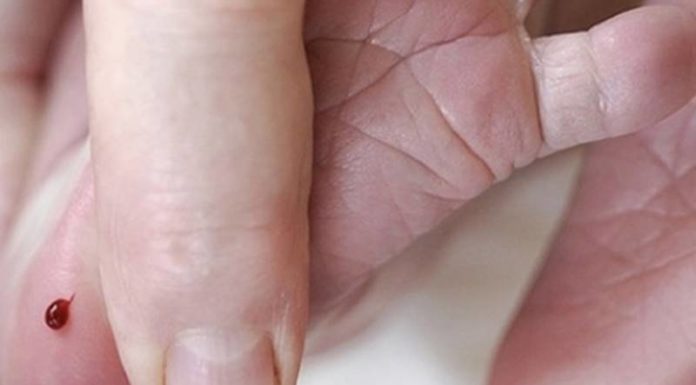 What is a Heel Stick Blood Test? Why is Blood Drawn from a Baby’s Heel?