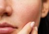 5 Simple Hacks to Shrink Those Enlarged Pores