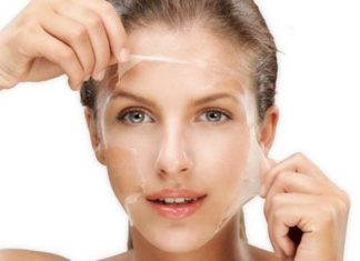 Is Chemical Peel a Good Treatment for Melasma?