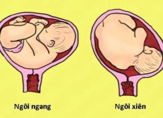 What is a Transverse Lie? Understanding Transverse Lie and What to Do.