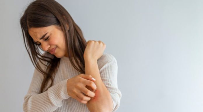 What Should Those With Atopic Dermatitis Be Aware Of During Hot, Sunny Weather?