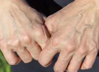 Is Visible Blue Veins on Hands and Feet a Sign of an Underlying Health Condition?