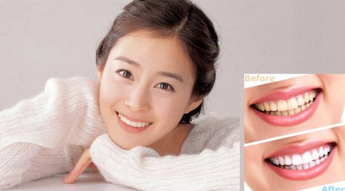 8 Teeth-Whitening Hacks for a Brighter, More Radiant Smile