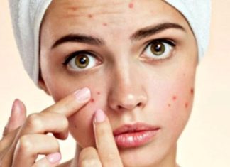 The 3 Severe Consequences of Popping Pimples
