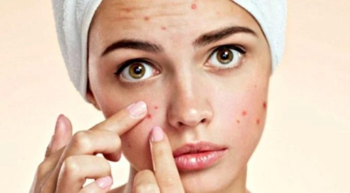 The 3 Severe Consequences of Popping Pimples