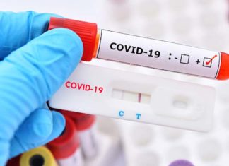 Is It a Faint or Dark Line on Your COVID Test? Understanding the Results.
