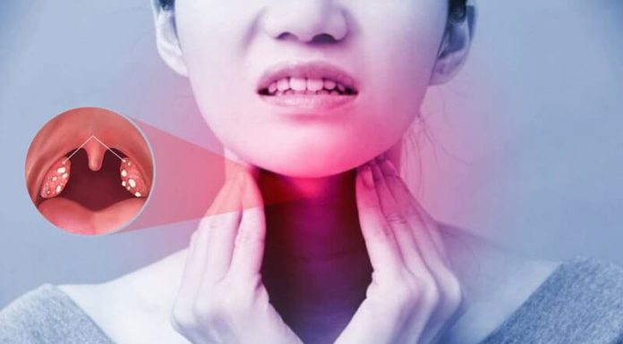 A Tasty Solution for Tonsillitis: Eating Right to Ease the Pain