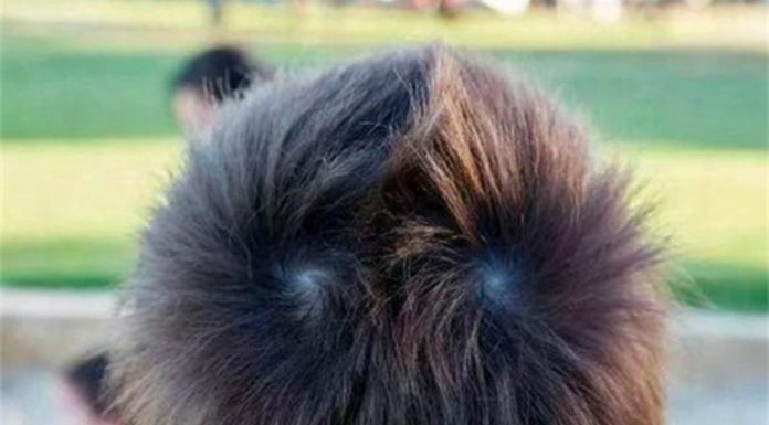 Is There Any Truth to the Claim That Children with Two Hair Whorls Are More Intelligent and Have a Higher IQ?