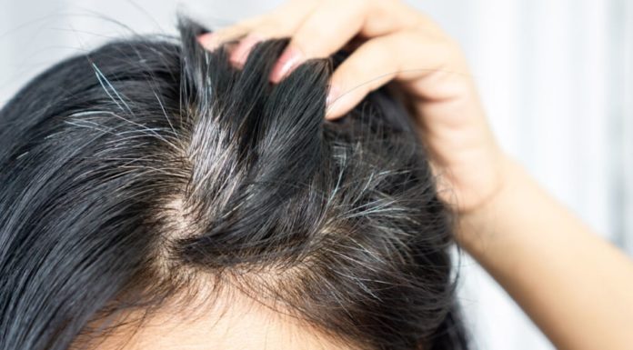 The Secret to Reversing Premature Graying: Are You Missing These 5 Essential Nutrients?