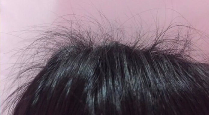 “Taming the Wild Mane: A Guide to Managing Unruly Hair”