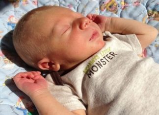 The Ultimate Guide to Natural Remedies for Jaundice in Newborns: 10 Effective Tips for Parents