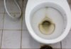 8 Powerful Ways to Remove Stubborn Yellow Stains and Make Your Toilet Bowl Shine