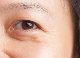 The Ultimate Guide: Smooth Out Crow’s Feet and Banish Eye Wrinkles