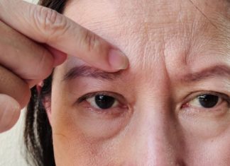 The 4 Problem Areas: A Guide to Early Aging and Skincare Secrets for a Youthful Glow