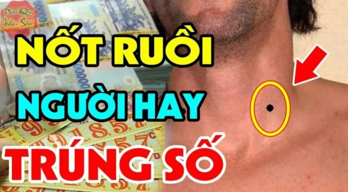 The Lucky Three: Moles Worth More Than Gold for Men