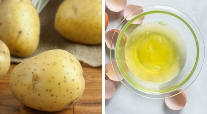 3 Ways to Prevent Your Leather Shoes From Peeling