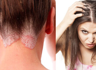 How to Spot a Fake Shampoo