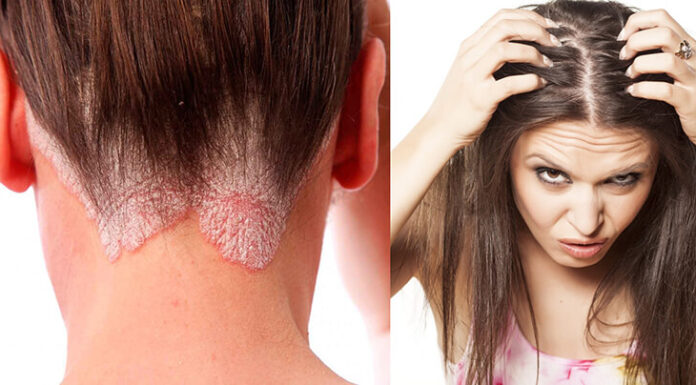 How to Spot a Fake Shampoo