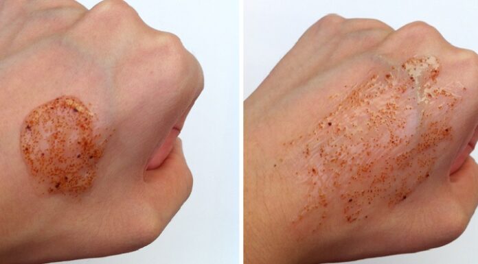 The Perfect Exfoliation Guide for Every Skin Type