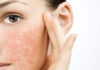 “Saving Your Skin: A Guide to Combating Cosmetic Allergies”