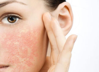 “Saving Your Skin: A Guide to Combating Cosmetic Allergies”