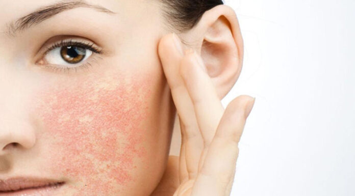 “Saving Your Skin: A Guide to Combating Cosmetic Allergies”