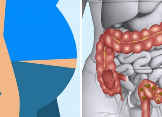 The Perils of a Meat-Heavy Diet: Are You Eating Too Much?