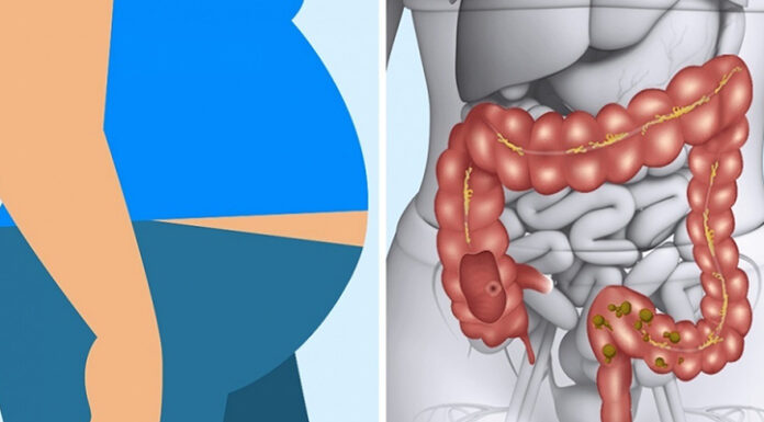 The Perils of a Meat-Heavy Diet: Are You Eating Too Much?