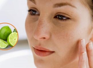 5 Natural Remedies for Freckles: Simple and Effective Solutions