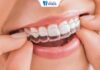 The Cost of Invisalign: A Comprehensive Guide