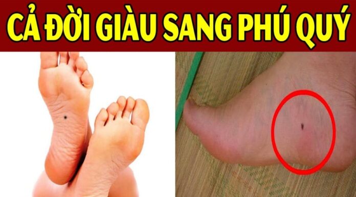 The Ultimate Guide to Success: The 5 Moles Worth More Than Gold