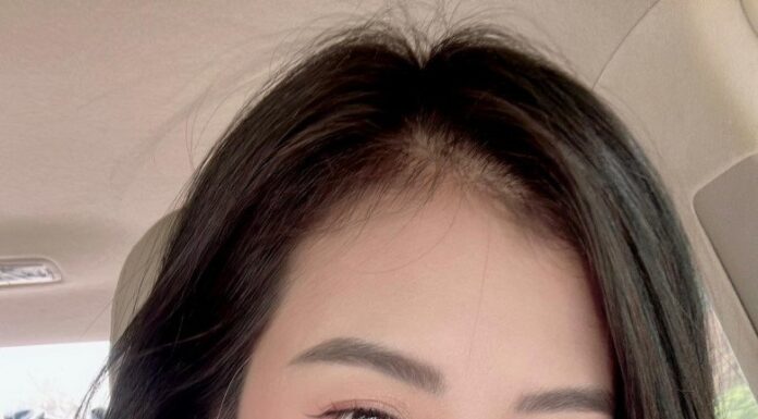 The Ultimate Guide to Storing Lotus Seeds: A Mother’s Secret to Year-Round Golden Perfection