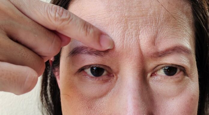 The Skin’s Wrinkle-Prone Areas and How to Care for Them Effectively