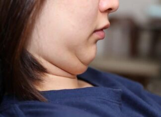 The Ultimate Guide to Getting Rid of a Double Chin: 7 Simple and Effective Exercises