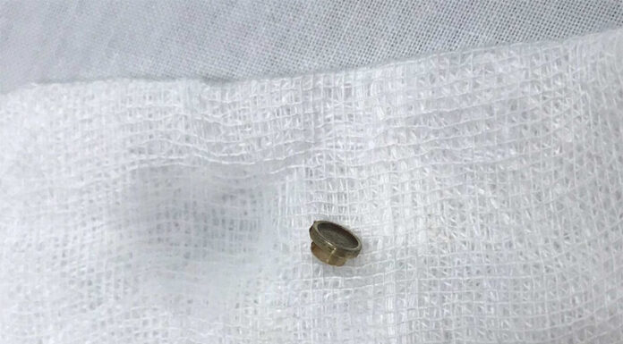 The Dangers of Sleeping With Earphones: A Narrow Escape From Ruptured Eardrums