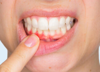 Why Do Some People Experience a Sour Taste in Their Mouth After Eating Something Sweet?