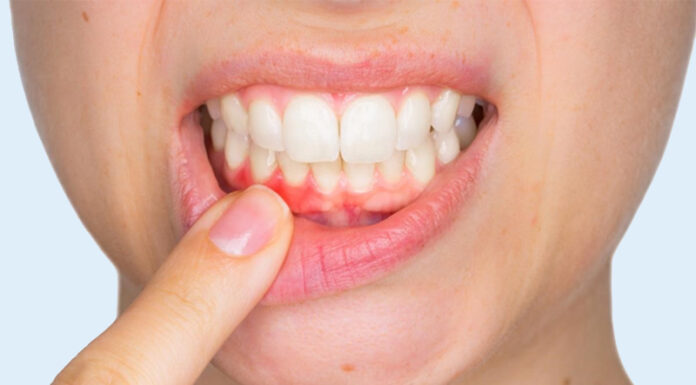 Why Do Some People Experience a Sour Taste in Their Mouth After Eating Something Sweet?