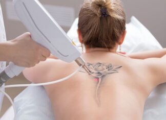 Does Tattoo Removal Hurt? 5+ Home Remedies to Remove Tattoos