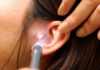 The Ultimate Guide to Removing Insects from Your Ear: A Step-by-Step Solution