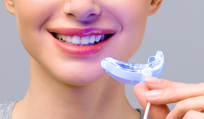 The Ultimate Guide to Teeth Whitening: 4 Simple and Affordable Home Remedies for a Brighter Smile.