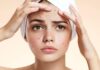 “The Acne Enigma: Unveiling the Secret to Clear Skin”