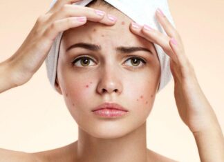 “The Acne Enigma: Unveiling the Secret to Clear Skin”