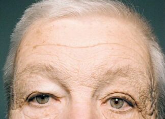 “4 Aging Habits You Need to Stop, Says Dermatologist: It’s Not Just About Collagen”