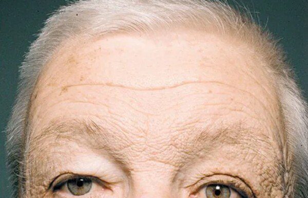 “4 Aging Habits You Need to Stop, Says Dermatologist: It’s Not Just About Collagen”